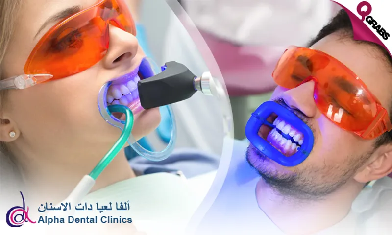 Fläsh Teeth Whitening at Alpha Dental Clinics!